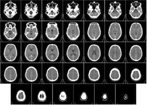 dia mundial del cerebro