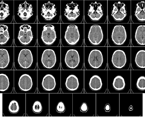 dia mundial del cerebro